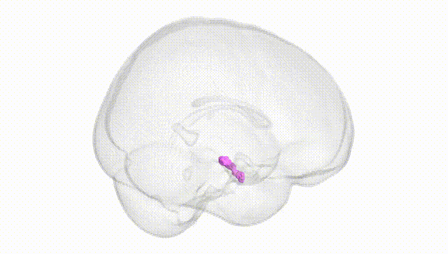 Full Brain White