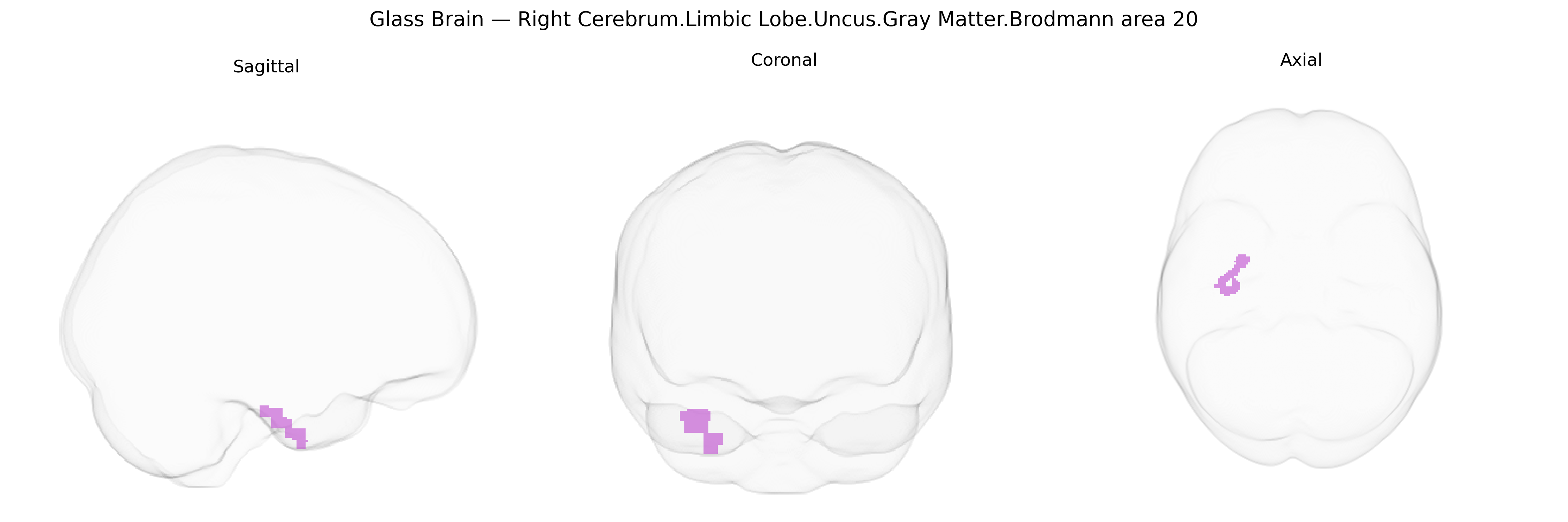Triplanar Ghost Brain