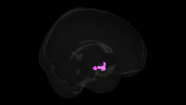 Full Brain Black