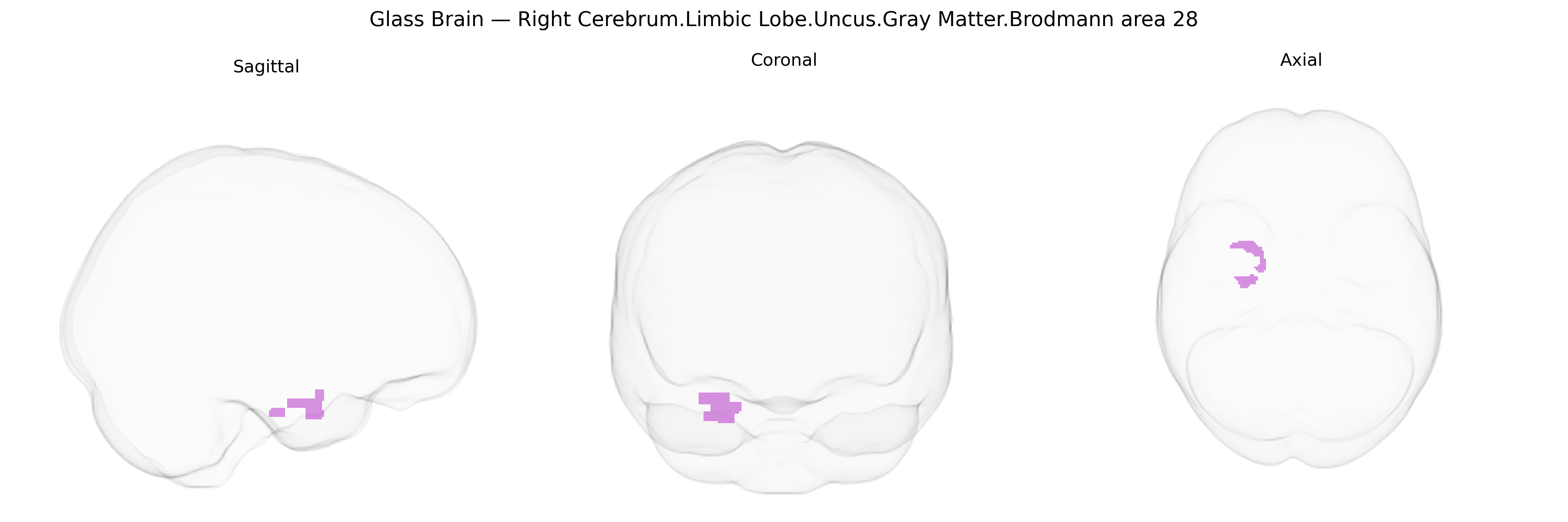Triplanar Ghost Brain