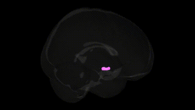Full Brain Black