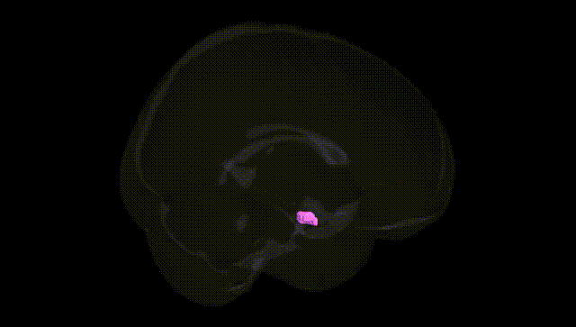 Full Brain Black