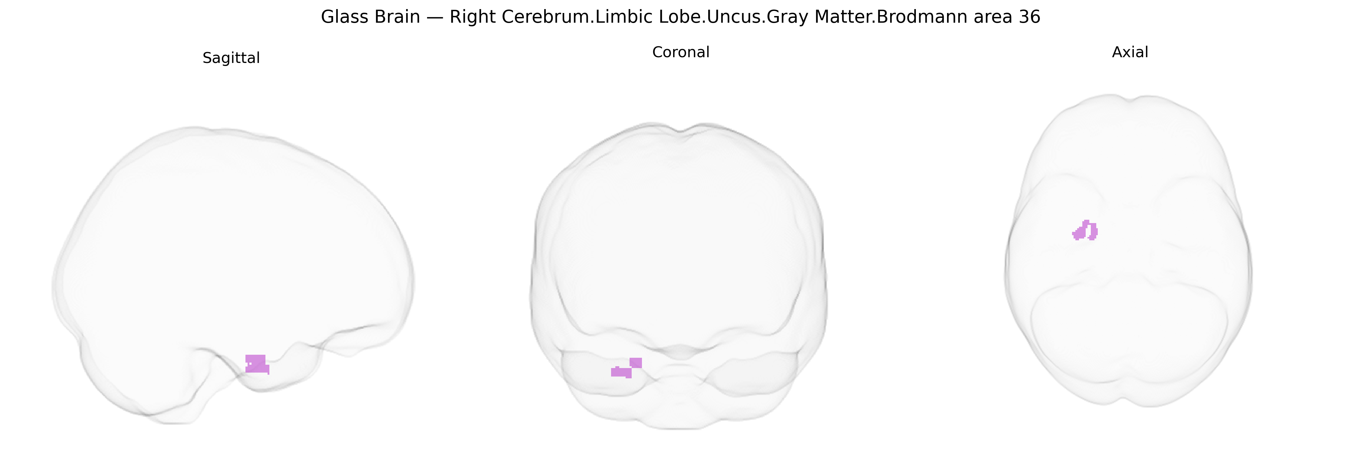Triplanar Ghost Brain