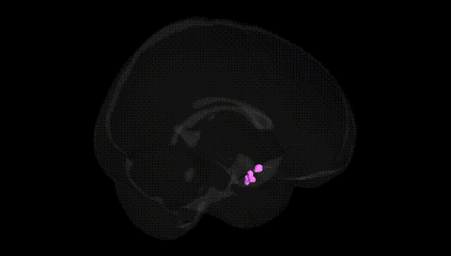 Full Brain Black