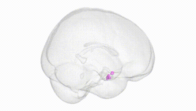 Full Brain White