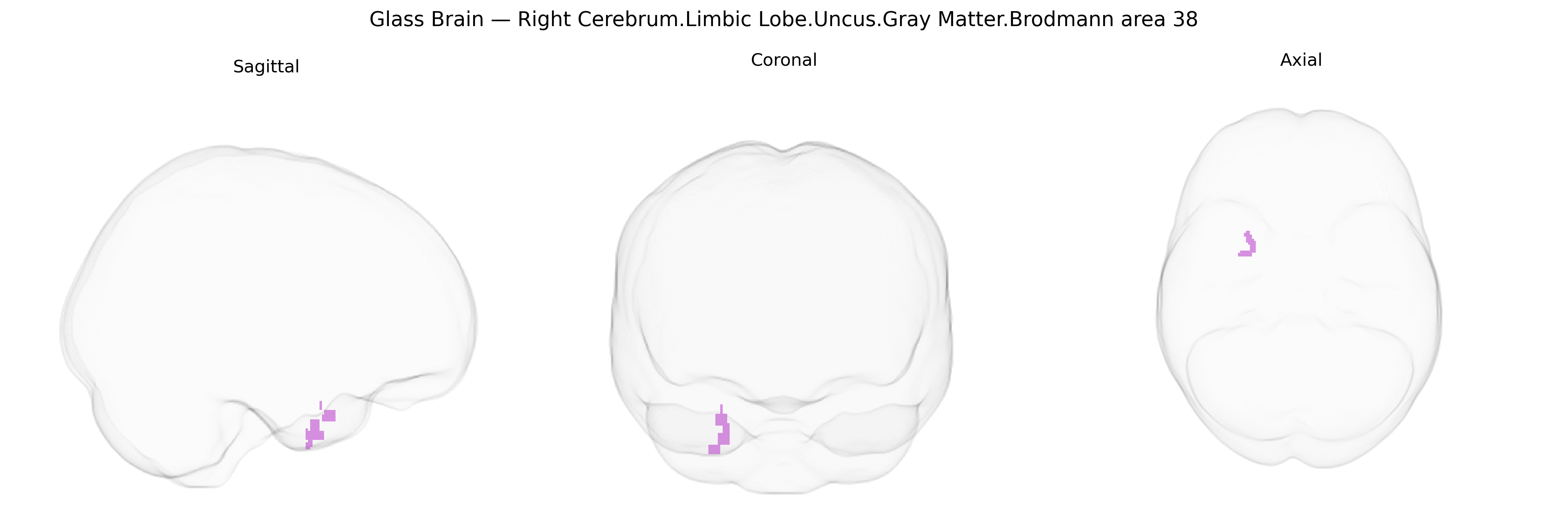 Triplanar Ghost Brain
