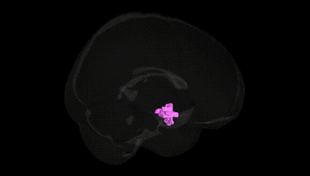 Full Brain Black