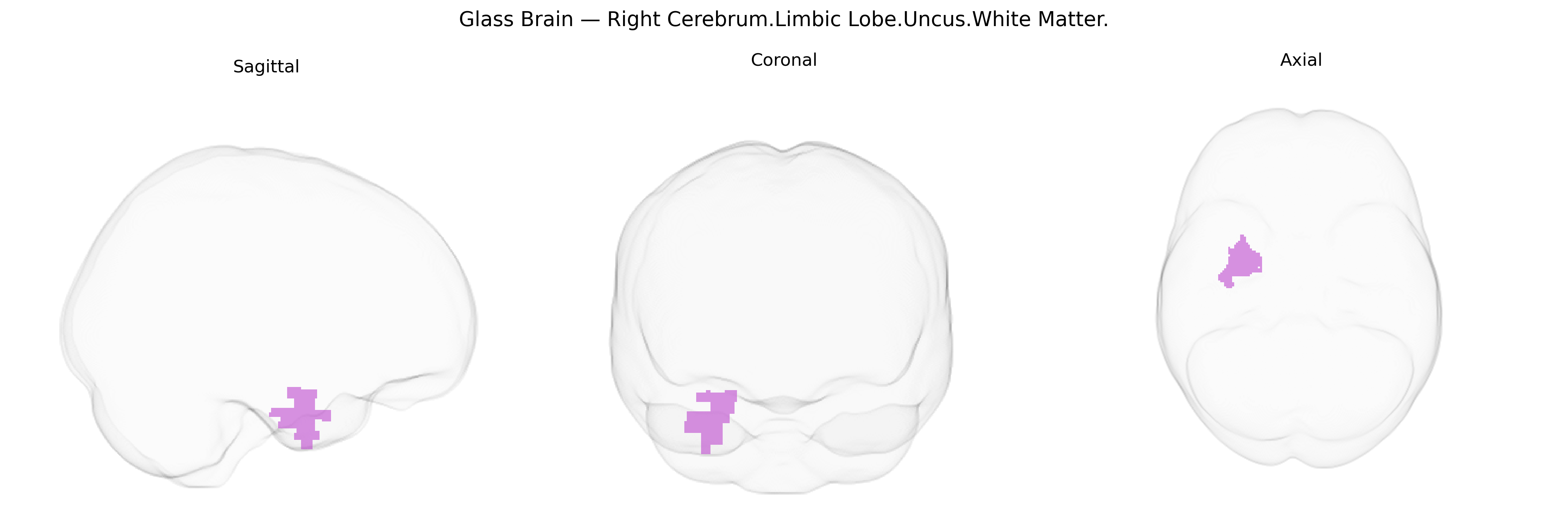 Triplanar Ghost Brain