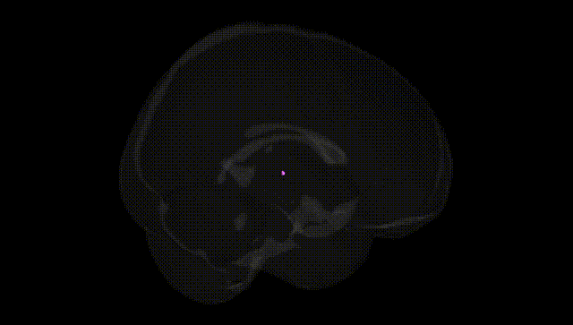 Full Brain Black