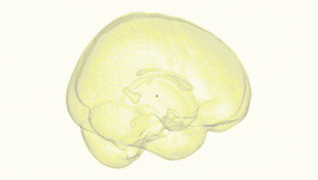 Full Brain White