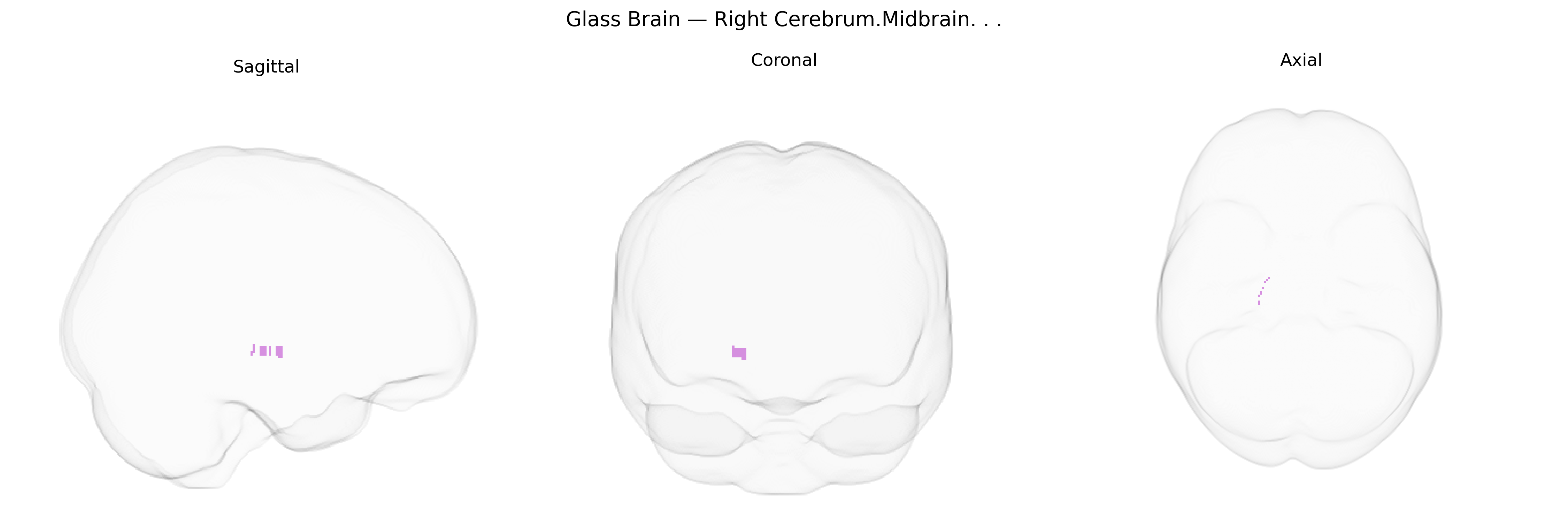 Triplanar Ghost Brain