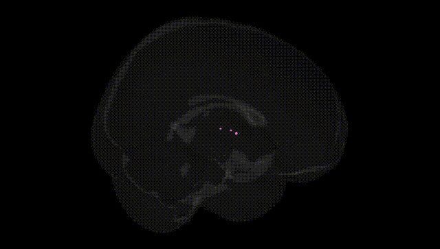 Full Brain Black