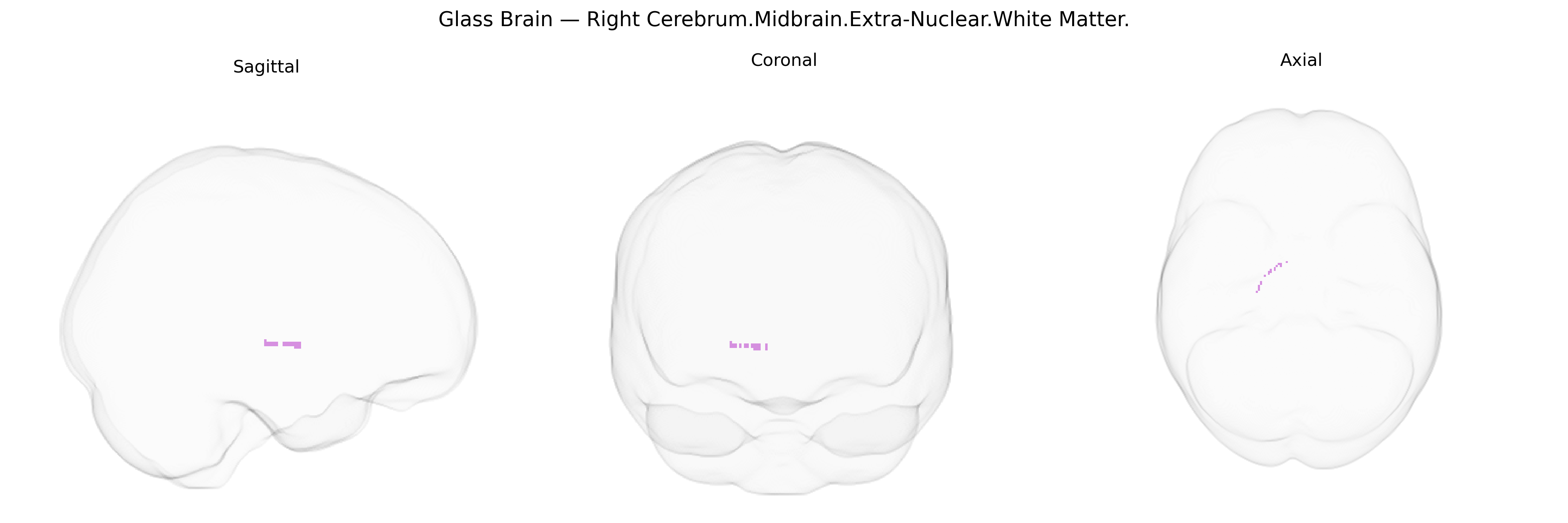 Triplanar Ghost Brain