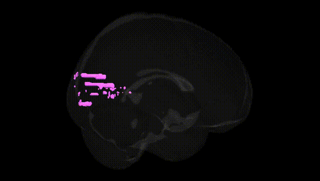 Full Brain Black