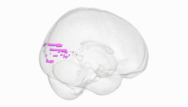 Full Brain White