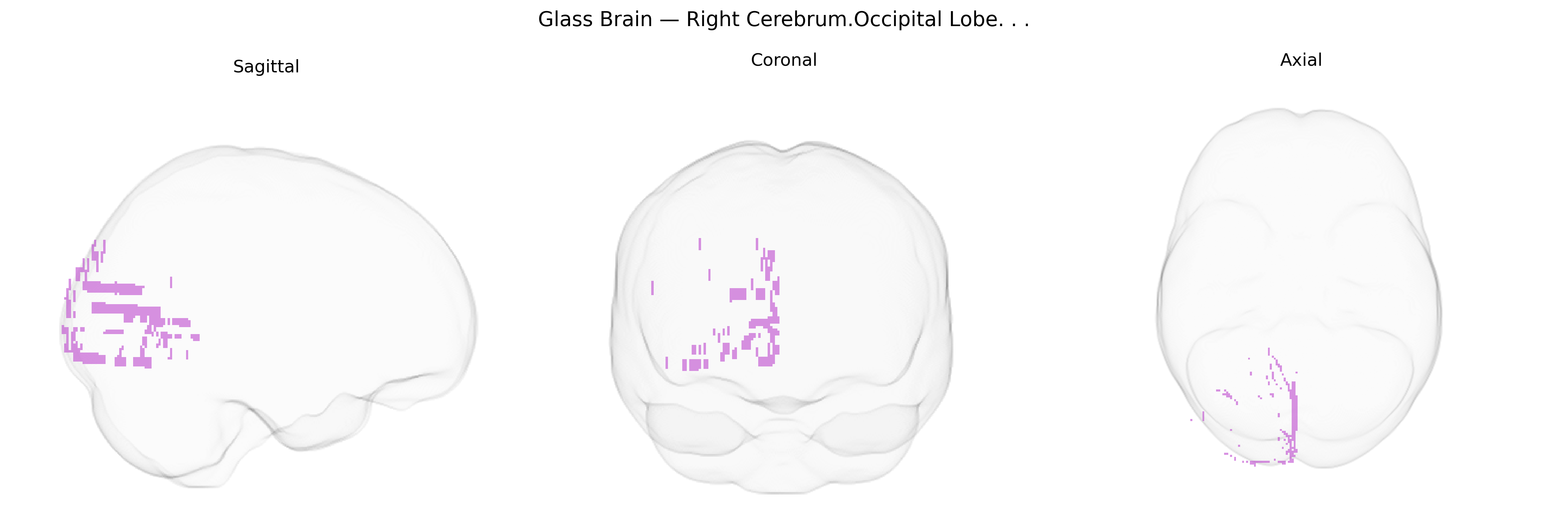 Triplanar Ghost Brain