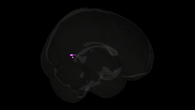Full Brain Black