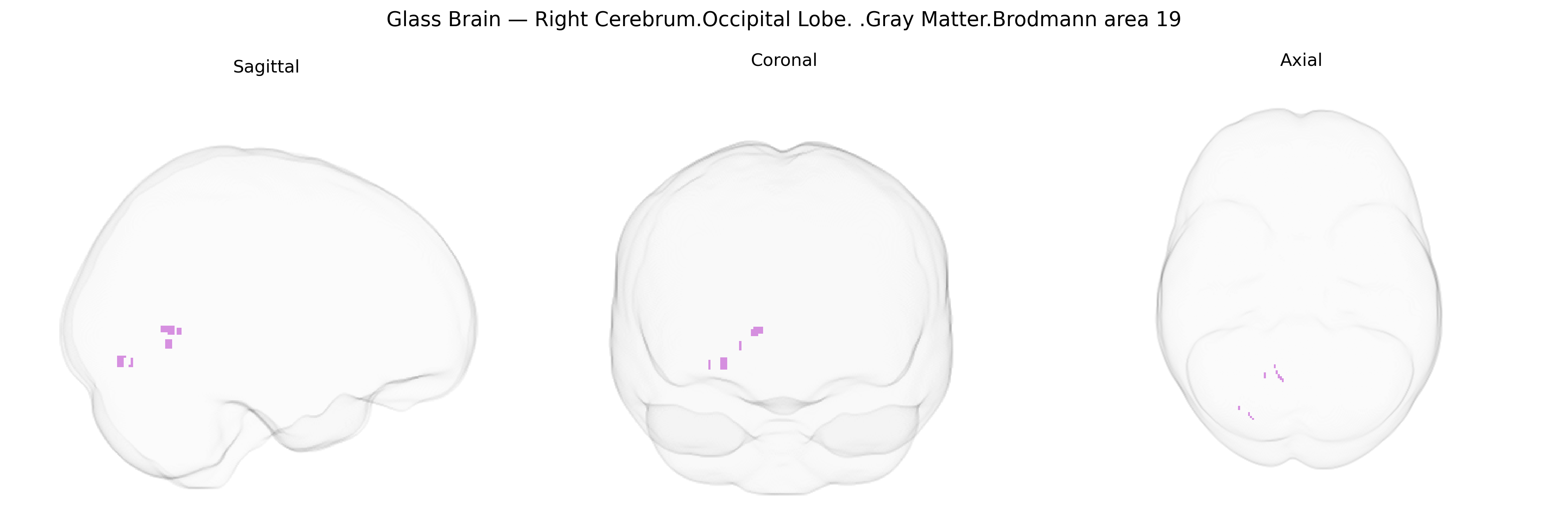Triplanar Ghost Brain