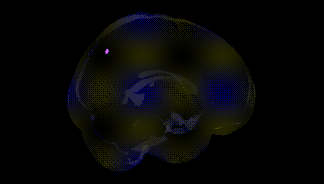 Full Brain Black