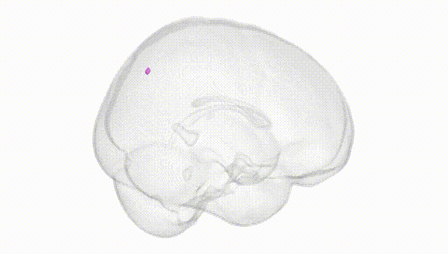 Full Brain White