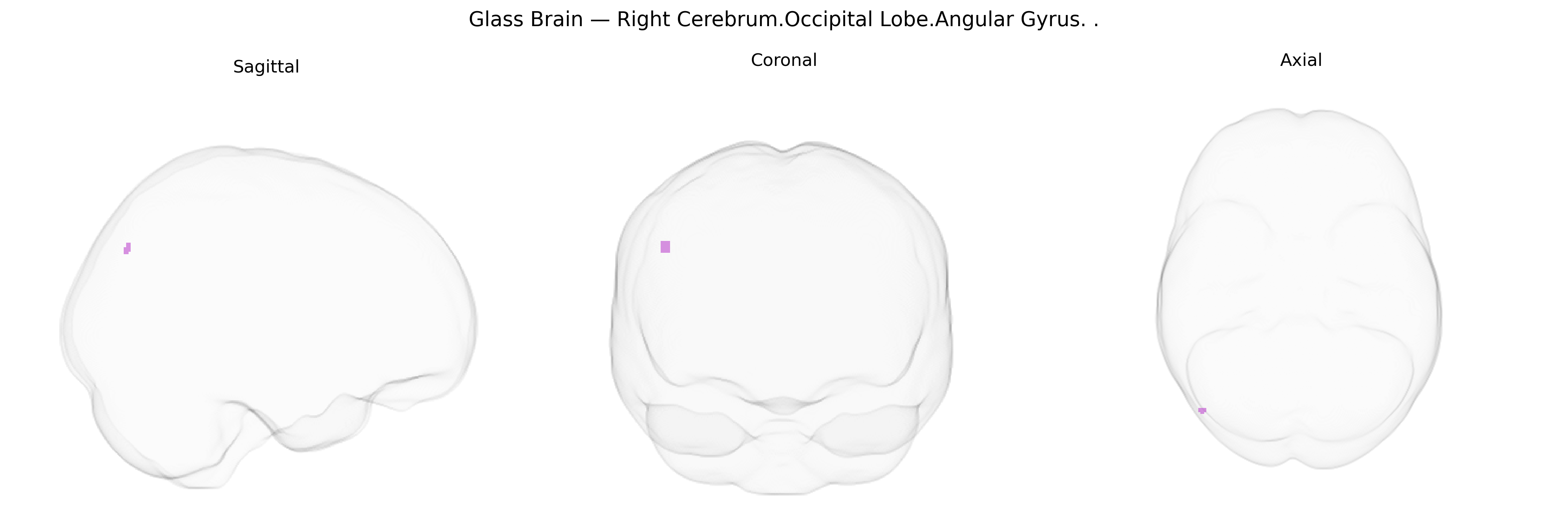 Triplanar Ghost Brain
