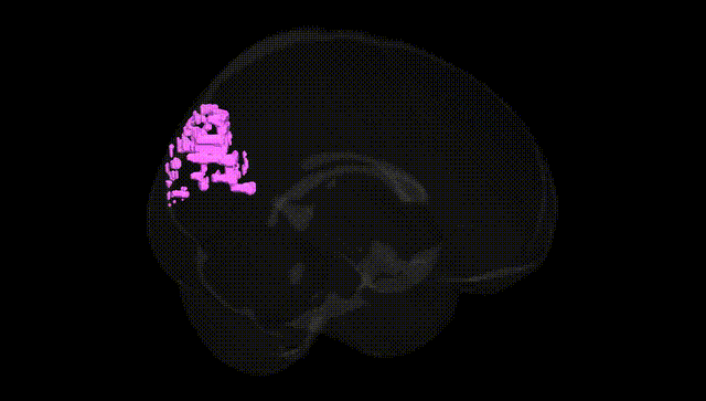 Full Brain Black