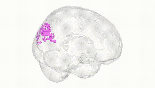 Full Brain White