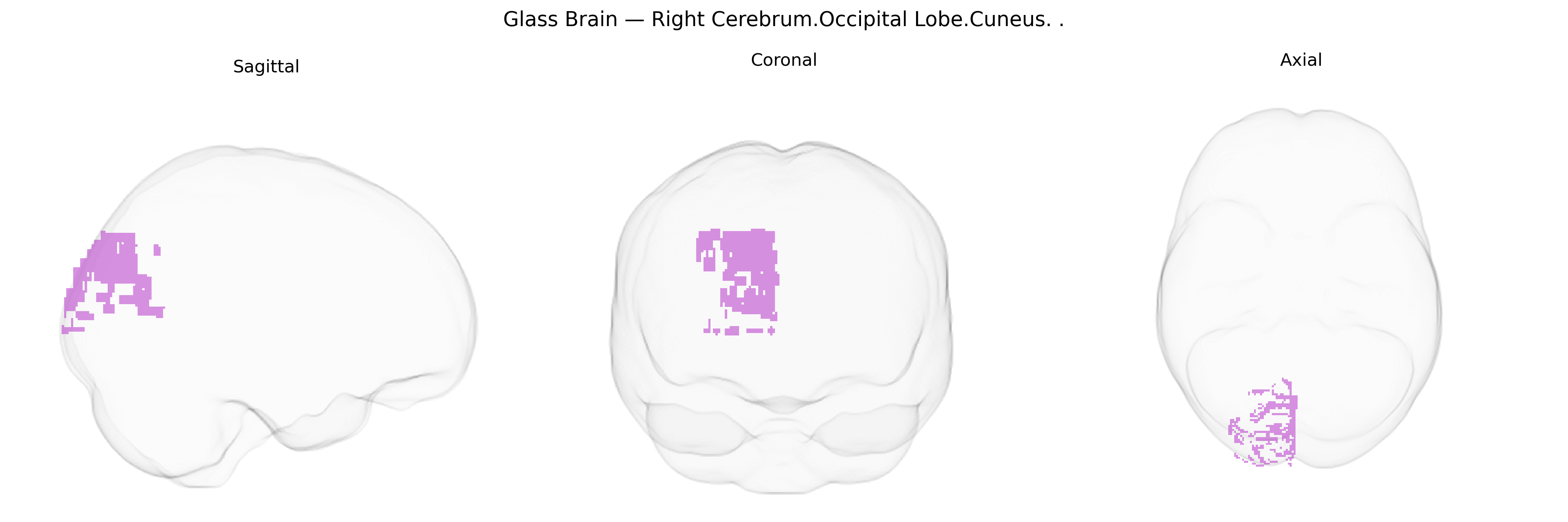 Triplanar Ghost Brain