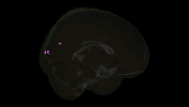 Full Brain Black