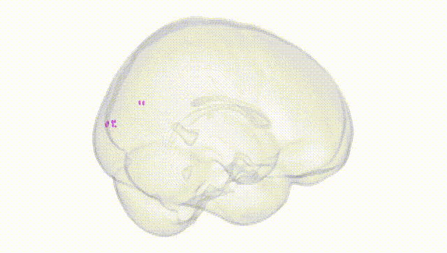 Full Brain White