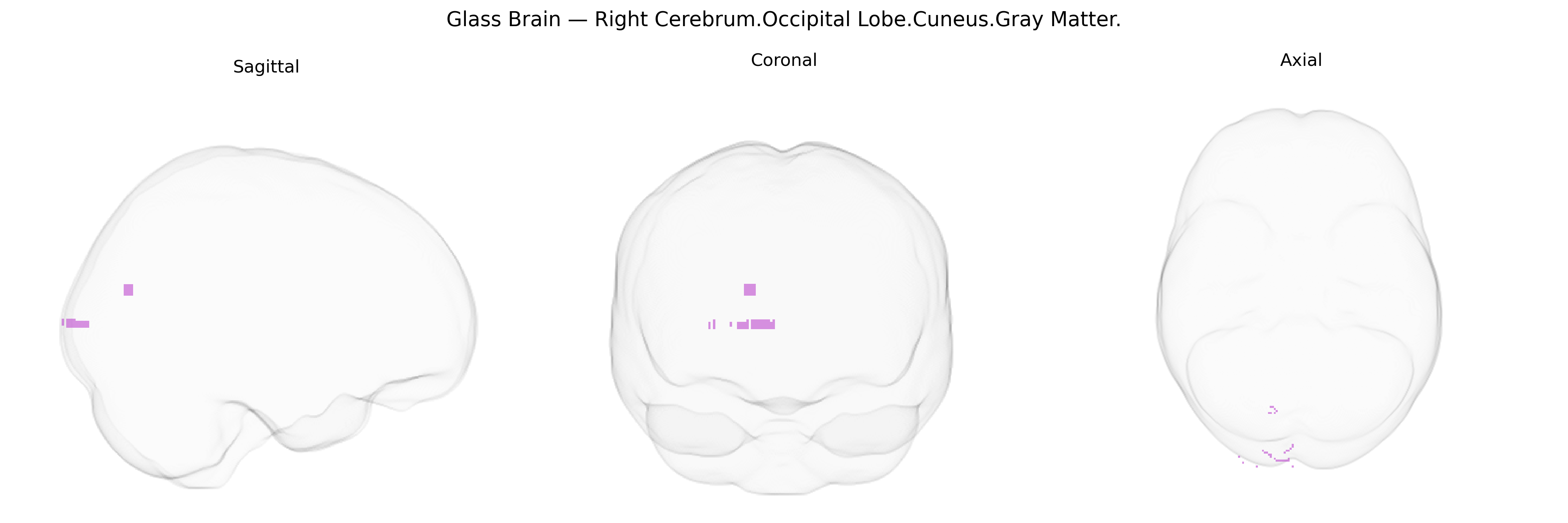 Triplanar Ghost Brain