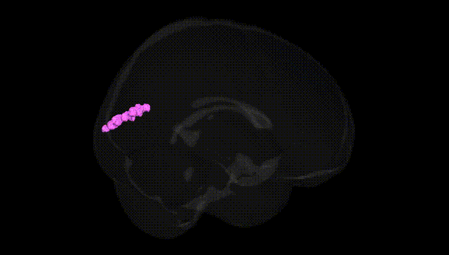 Full Brain Black