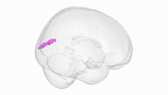 Full Brain White