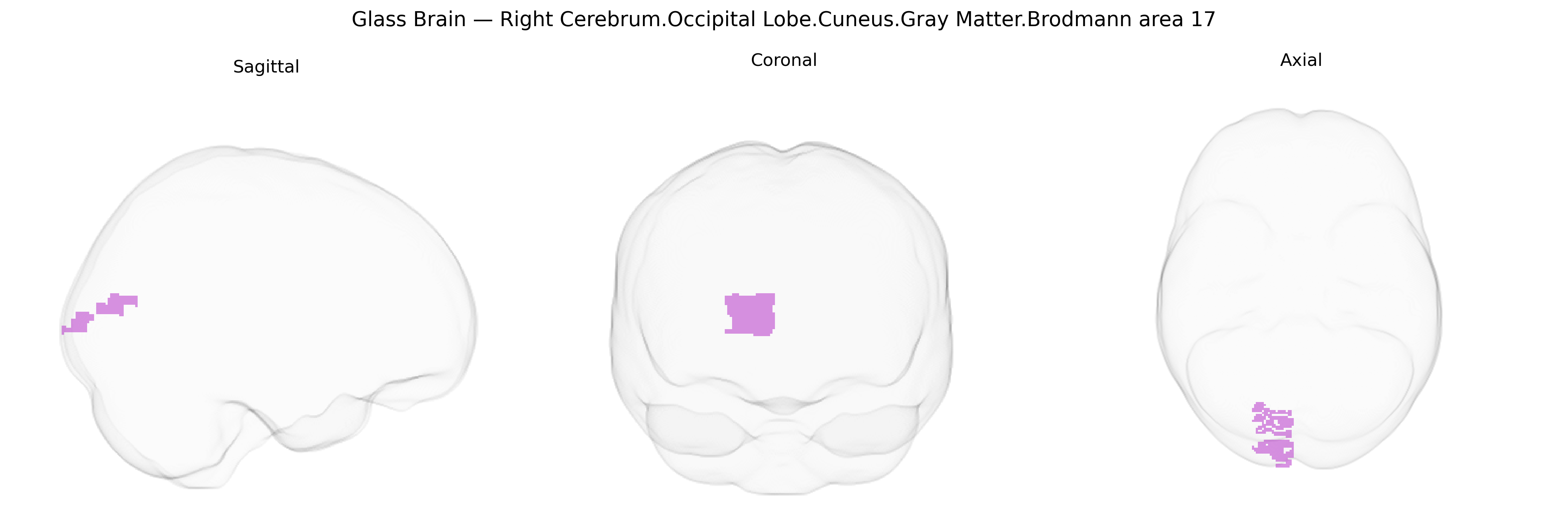 Triplanar Ghost Brain