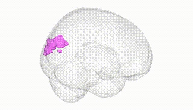 Full Brain White