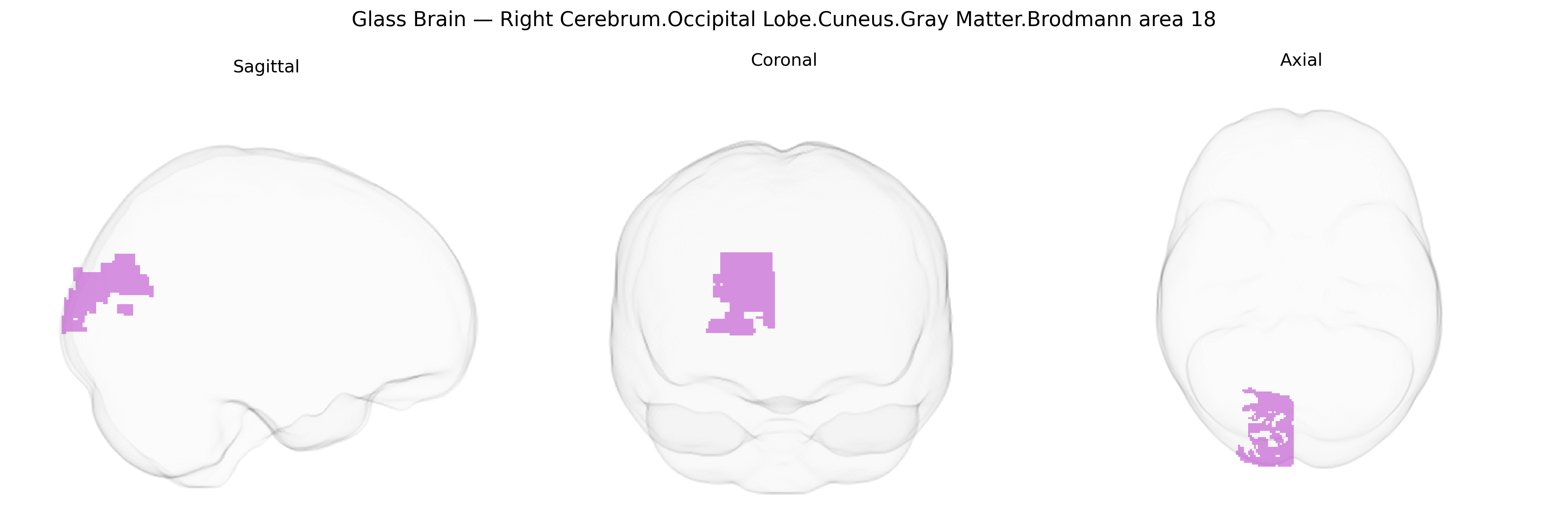 Triplanar Ghost Brain
