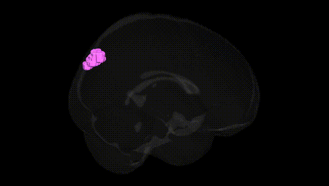 Full Brain Black