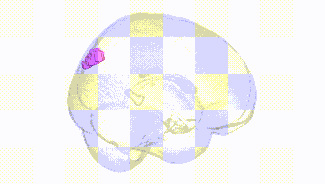 Full Brain White