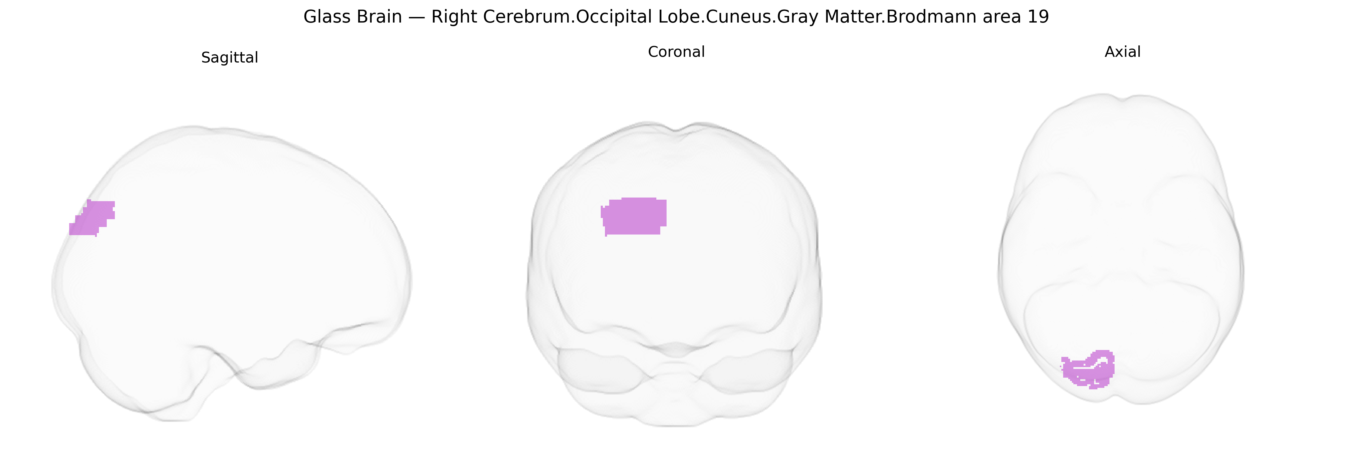 Triplanar Ghost Brain