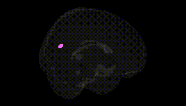 Full Brain Black