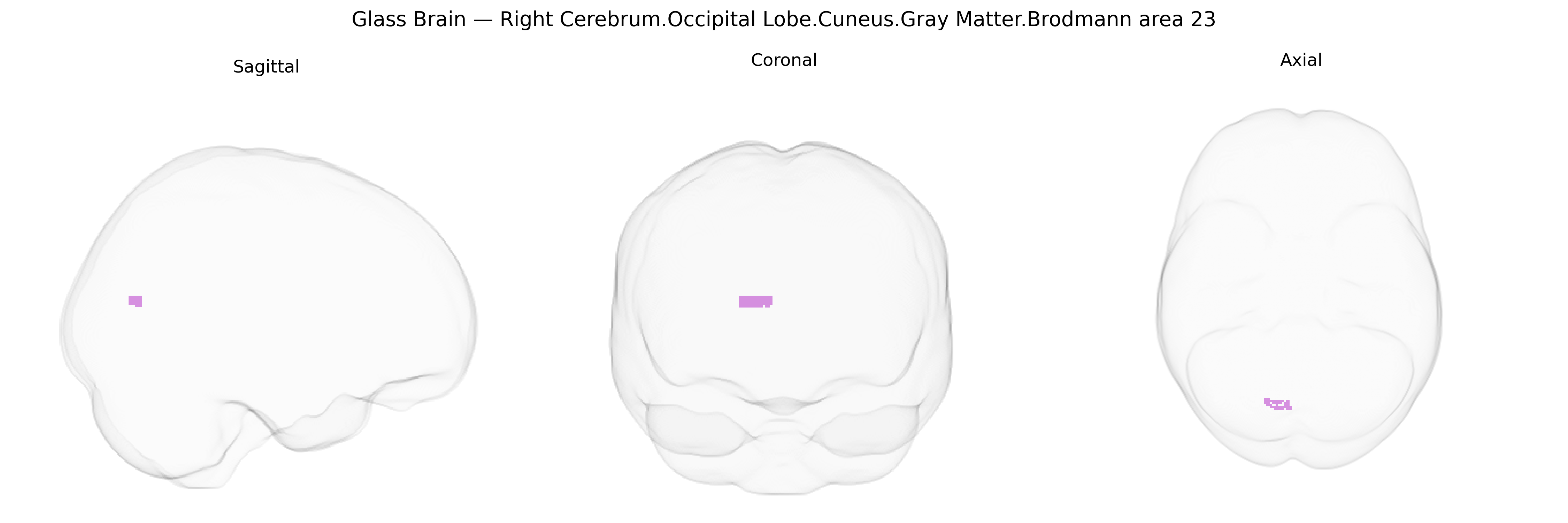 Triplanar Ghost Brain