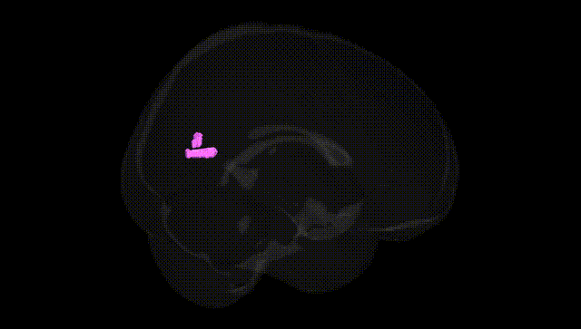 Full Brain Black