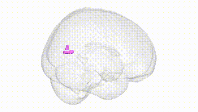 Full Brain White