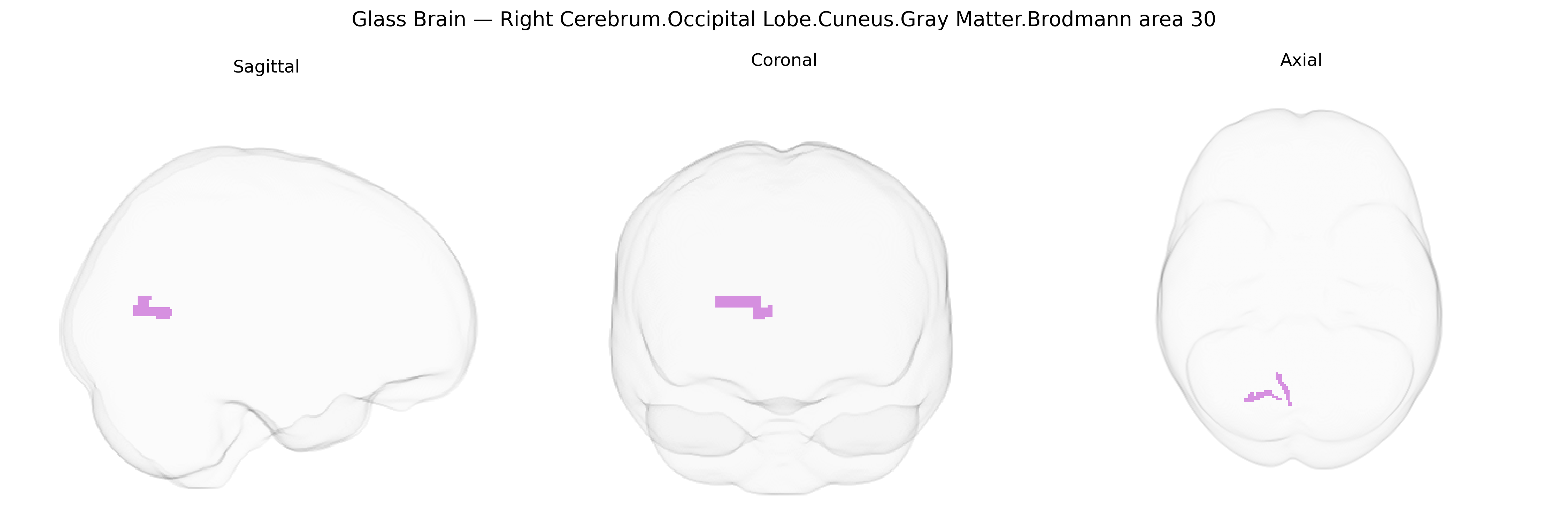 Triplanar Ghost Brain