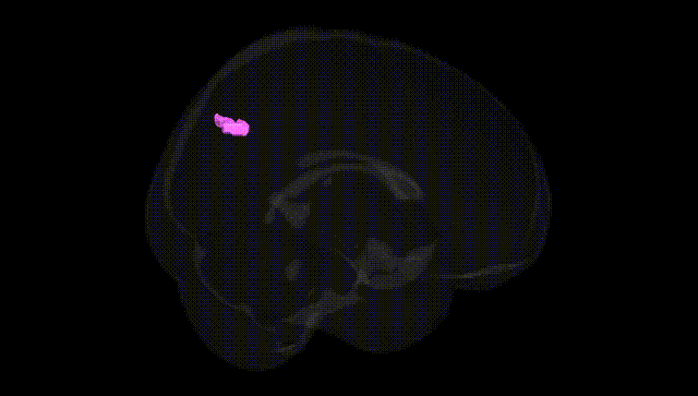 Full Brain Black