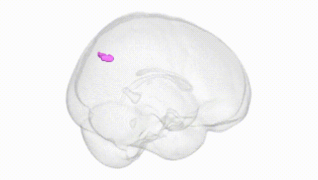 Full Brain White