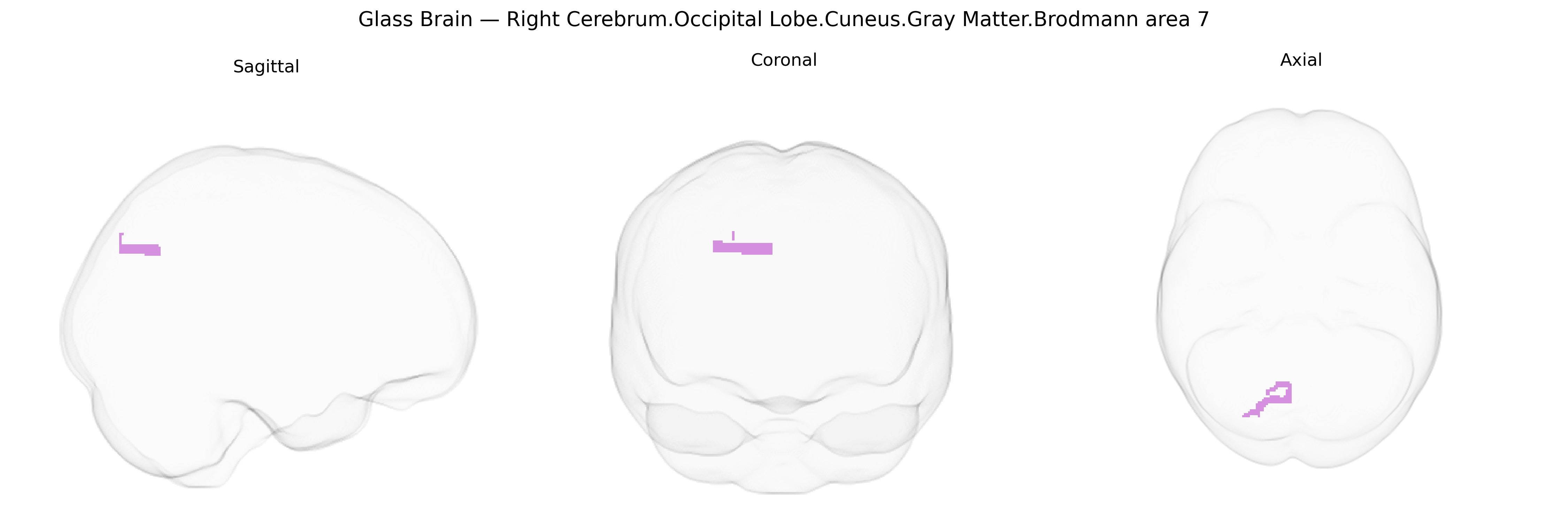 Triplanar Ghost Brain