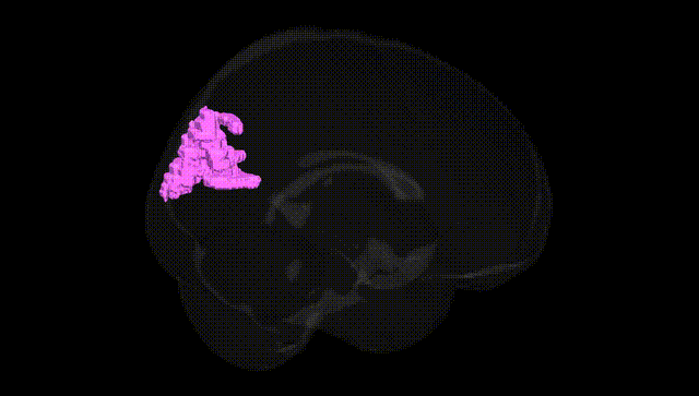Full Brain Black