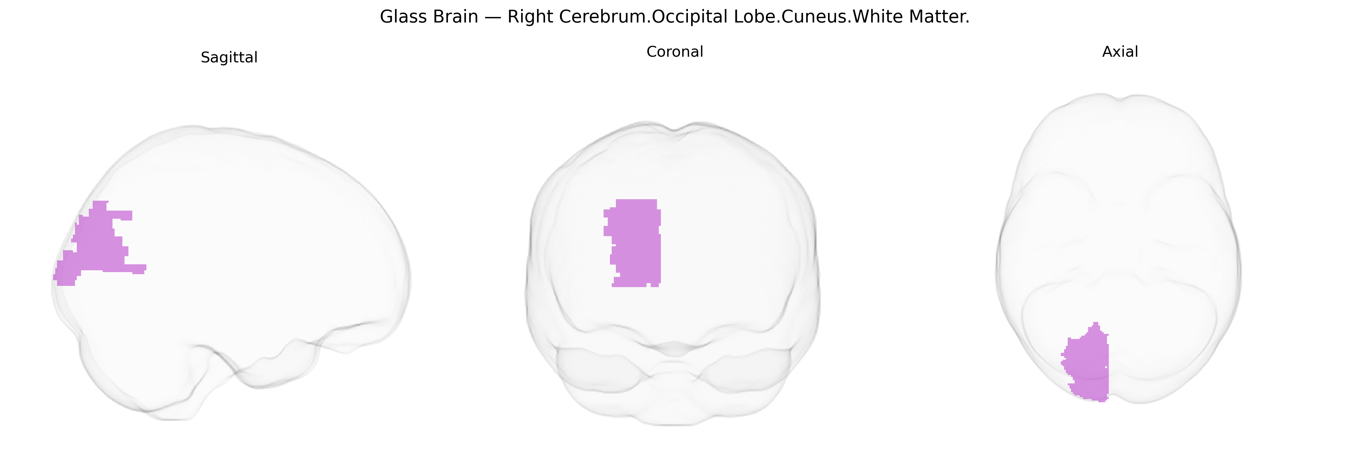 Triplanar Ghost Brain