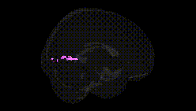 Full Brain Black